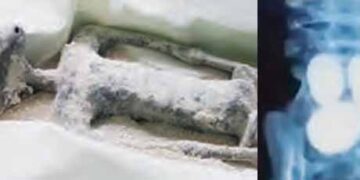 Eggs found inside alien bodies