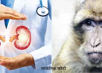 Monkey lived 2 years after pig kidney transplant