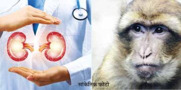 Monkey lived 2 years after pig kidney transplant