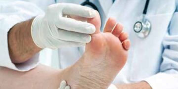 Angioplasty is done not only for the heart but also for the legs.