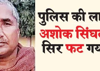 Ashok Singhal's head was broken by the police baton