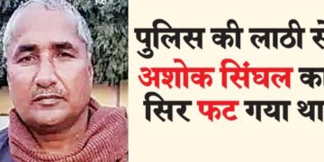 Ashok Singhal's head was broken by the police baton