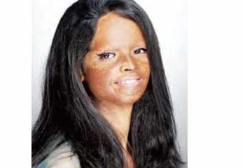 Acid victims will be heard