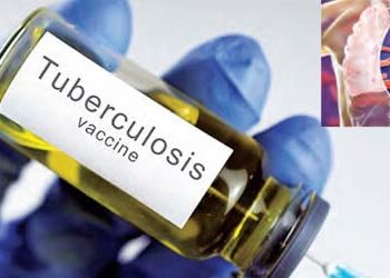 Now BCG vaccine will be tested