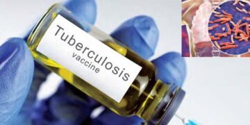 Now BCG vaccine will be tested