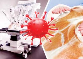 Doctors gave life to 15 women by performing robotic surgery for breast cancer.