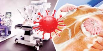 Doctors gave life to 15 women by performing robotic surgery for breast cancer.