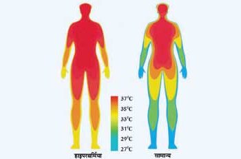 Danger to human brain due to high temperature