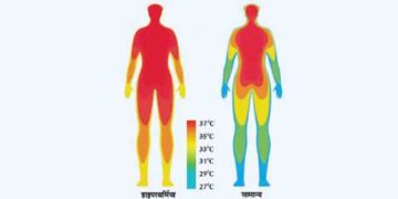 Danger to human brain due to high temperature