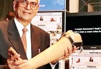 Artificial legs given to 21 lakh people