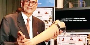 Artificial legs given to 21 lakh people