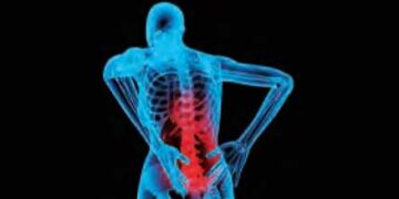 If you want to stop back pain then do walking