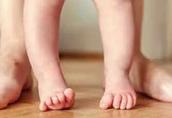 Improving the lives of children with congenitally bent legs
