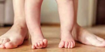 Improving the lives of children with congenitally bent legs