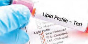 Lipid profile of 81 percent Indians is bad