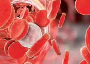 अब रक्त नमूनों की गुणवत्ता खराब होने से बचाएगी पीसीएम तकनीक