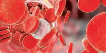 अब रक्त नमूनों की गुणवत्ता खराब होने से बचाएगी पीसीएम तकनीक