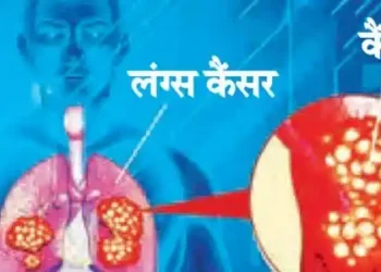 30 percent of lung cancer patients in the capital are 'non-smokers'