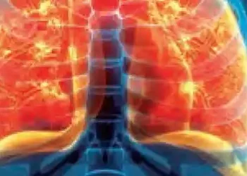 47 percent of Mumbai's bakeries are spreading pollution