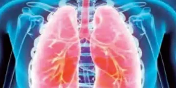 AI will tell about lung disease by the sound of cough