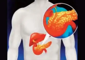 The liver of even younger people is becoming fatty