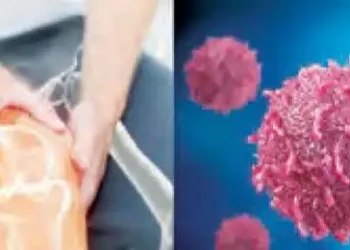Does Vitamin D deficiency cause cancer?